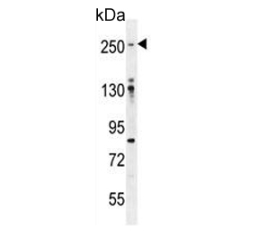 Western blot testing of human U-251 cell lysate with Filamin A antibody. Predicted molecular weight ~281 kDa.