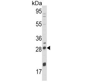 Beta-Nerve Growth Factor Antibody NCI-H460 WB. Western blot analysis of human NCI-H460 cell lysate using Beta-Nerve Growth Factor Antibody / Neurotrophic Signaling Antibody. A distinct band is detected near 27-28 kDa, consistent with the predicted molecular weight of mature beta-NGF / Nerve growth factor dimer-associated forms. The observed signal aligns with processed neurotrophin expression and intracellular neurotrophic signaling biology in human lung carcinoma cells.