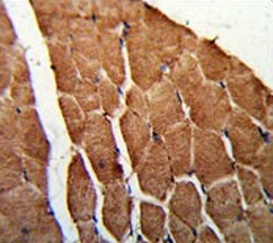 IHC testing of FFPE human skeletal muscle tissue with CCHCR1 antibody. HIER: steam section in pH6 citrate buffer for 20 min and allow to cool prior to staining.