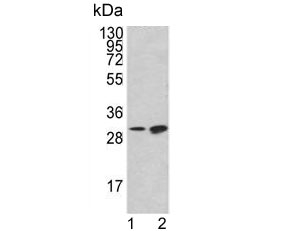 Western blot testing of human 1) K562 and 2) HL60 cell lysate with Bcl-2-like protein 11 antibody. Predicted molecular weight ~22 kDa.