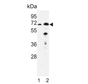 Western blot testing of mouse 1) liver and 2) kidney tissue lysate with EHHADH antibody. Predicted molecular weight ~79 kDa.