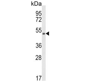 Western blot testing of human CCRF-CEM cell lysate with KMO antibody. Expected molecular weight: 52-56 kDa (multiple isoforms).