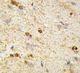 IHC testing of FFPE human brain tissue with QDPR antibody. HIER: steam section in pH6 citrate buffer for 20 min and allow to cool prior to staining.
