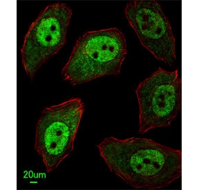 Immunofluorescent staining of human U-251 cells with APEX2 antibody (green) and anti-Actin (red).