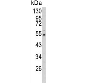 Western blot testing of mouse lung tissue lysate with EFEMP1 antibody. Predicted molecular weight ~54 kDa.