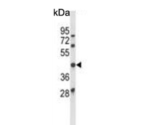 Western blot testing of human MCF7 cell lysate with Ataxin 3 antibody. Predicted molecular weight ~42 kDa.