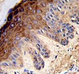 Topoisomerase II alpha Antibody Skin IHC. Immunohistochemistry testing of FFPE human skin tissue with Topoisomerase II alpha antibody. HIER: steam section in pH6 citrate buffer for 20 min and allow to cool prior to staining.