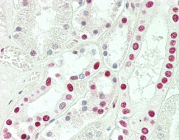 IHC testing of FFPE human kidney tissue with Sm-D3 antibody. HIER: steam section in pH6 citrate buffer for 20 min and allow to cool prior to staining.