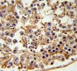 IHC testing of FFPE human testis tissue with FANCC antibody. HIER: steam section in pH6 citrate buffer for 20 min and allow to cool prior to staining.