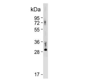 DIO3 Antibody Placenta WB. Western blot analysis of human placental tissue lysate using DIO3 Antibody / Thyroid Hormone Metabolism Enzyme Antibody demonstrates a prominent immunoreactive band at approximately 31â37 kDa, consistent with the expected molecular weight range of DIO3 (Iodothyronine Deiodinase 3). DIO3 is the principal thyroid hormone-inactivating enzyme responsible for converting thyroxine (T4) and triiodothyronine (T3) into inactive metabolites, thereby regulating tissue-specific thyroid hormone availability. The strong signal observed in placental tissue is consistent with the important role of DIO3 in controlling fetal thyroid hormone exposure and maintaining endocrine homeostasis during development. Predicted molecular weight: ~34 kDa. Observed molecular weight: 31â37 kDa.