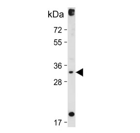 DIO3 Antibody HepG2 WB. Western blot analysis of human HepG2 cell lysate using DIO3 Antibody / Thyroid Hormone Metabolism Enzyme Antibody demonstrates a distinct immunoreactive band at approximately 31â37 kDa, consistent with the expected molecular weight range of DIO3 (Iodothyronine Deiodinase 3). DIO3 is a selenoprotein enzyme that catalyzes the inactivation of thyroid hormones, thereby regulating local thyroid hormone availability and endocrine signaling. Expression of DIO3 in HepG2 cells is consistent with its role in tissue-specific control of thyroid hormone metabolism and cellular homeostasis. The observed band supports specific detection of endogenous DIO3 and demonstrates the utility of this antibody for western blot applications. Predicted molecular weight: ~34 kDa. Observed molecular weight: 31â37 kDa.