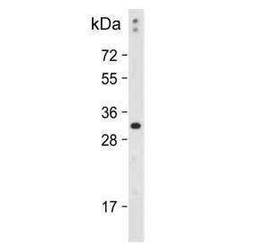 DIO3 Antibody Rat Skeletal Muscle WB. Western blot analysis of rat skeletal muscle tissue lysate using DIO3 Antibody / Thyroid Hormone Metabolism Enzyme Antibody demonstrates a distinct immunoreactive band at approximately 31â37 kDa, consistent with the expected molecular weight range of DIO3 (Iodothyronine Deiodinase 3). DIO3 functions as the primary thyroid hormone-inactivating deiodinase, catalyzing the conversion of thyroxine (T4) and triiodothyronine (T3) into inactive metabolites that regulate tissue-specific thyroid hormone signaling. Detection of DIO3 in skeletal muscle supports its role in controlling local endocrine activity, energy metabolism, and physiological adaptation within metabolically active tissues. The observed band demonstrates specific recognition of endogenous DIO3 and supports the utility of this antibody for western blot applications. Predicted molecular weight: ~34 kDa. Observed molecular weight: 31â37 kDa.
