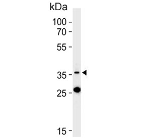 Western blot testing of human K562 cell lysate with Mitoferrin-1 antibody. Predicted molecular weight ~37 kDa.