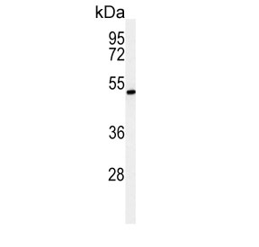 Western blot testing of mouse liver tissue lysate with ZDHHC9 antibody. Expected molecular weight: 41-46 kDa.