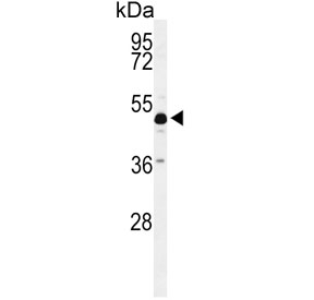 Western blot testing of mouse cerebellum tissue lysate with ANKH antibody. Predicted molecular weight ~54 kDa.
