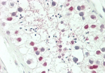 HOXA3 Antibody Human Testis IHC. IHC staining of FFPE human testis tissue with HOXA3 antibody demonstrated predominantly nuclear staining in germ cells within the seminiferous tubules, consistent with the localization of HOXA3 as a homeobox transcription factor that regulates developmental gene expression and cellular differentiation. Although HOXA3 is best known for its essential role in embryonic patterning and organogenesis, continued expression in adult reproductive tissues supports functions in germ cell development, tissue homeostasis, and reproductive biology. The nuclear staining pattern is consistent with the transcriptional regulatory activity of HOXA3. HIER was performed by steaming tissue sections in pH 6 citrate buffer for 20 minutes followed by cooling prior to staining. These results support the utility of HOXA3 Antibody for studies of developmental biology, reproductive biology, transcriptional regulation, and stem cell function.