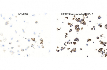 IHC staining of FFPE human NCI-H226 cells (left) and PD-L1 transfected HEK293 cells (right) with PD-L1 antibody. HIER: steam section in pH9 EDTA buffer for 20 min and allow to cool prior to staining.