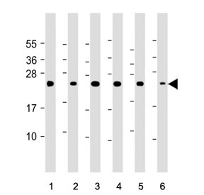 Western blot testing of human 1) Raji, 2) U266B1, 3) K562, 4) Jurkat,  5) CCRF-CEM and 6) human spleen tissue lysate with CTLA4 antibody. Predicted molecular weight ~25 kDa but may be observed at higher molecular weights due to glycosylation.