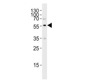 Western blot testing of human HL60 cell lysate with SLC29A1 antibody.  Predicted molecular weight ~50 kDa.