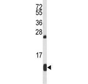 Western blot testing of mouse liver tissue lysate with HBA2 antibody.  Predicted molecular weight ~15 kDa.