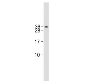 Western blot testing of human HACAT cell lysate with MARCO antibody. Predicted molecular weight ~53 kDa and ~44 kDa (two isoforms).
