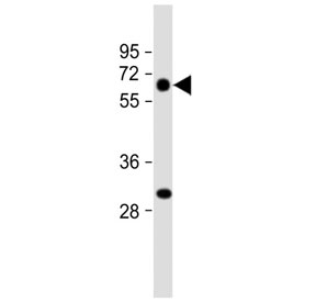 Western blot testing of human lung tissue lysate with CRCL antibody. Predicted molecular weight ~53 kDa.