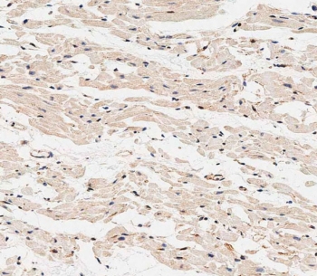 IHC staining of FFPE human heart tissue with CRCL antibody. HIER: steam section in pH9 EDTA buffer for 20 min and allow to cool prior to staining.