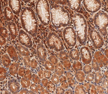 Cx40 Antibody Human Stomach IHC. Immunohistochemistry staining of FFPE human stomach tissue using Cx40 antibody demonstrates widespread cytoplasmic and membranous staining throughout gastric epithelial cell populations, consistent with expression of Connexin 40 (Cx40/GJA5). Cx40 is a gap junction protein that forms intercellular channels facilitating the direct exchange of ions, metabolites, and signaling molecules between neighboring cells. The observed staining pattern is consistent with the role of connexin proteins in coordinating cell-to-cell communication, maintaining tissue organization, and supporting physiologic homeostasis within epithelial tissues. These findings support the utility of Cx40 antibody for studies of gap junction biology, intercellular communication, and connexin-mediated signaling pathways. HIER: steam section in pH9 EDTA buffer for 20 min and allow to cool prior to staining.