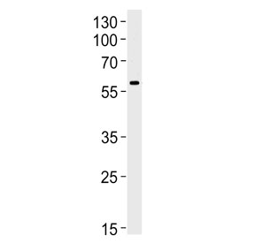 Western blot testing of human brain tissue lysate with Syncytin 1 antibody. Predicted molecular weight: 60~80 kDa depending on glycosylation level.