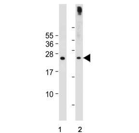 Western blot testing of human 1) Jurkat and 2) Raji cell lysate with Phorbolin 1 antibody. Predicted molecular weight ~23 kDa.