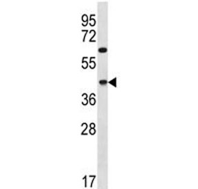 Western blot testing of human A549 cell lysate with MCUB antibody. Predicted molecular weight ~39 kDa.