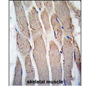 IHC staining of FFPE human skeletal muscle tissue with GREM1 antibody. HIER: steam section in pH6 citrate buffer for 20 min and allow to cool prior to staining.