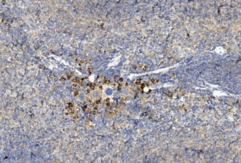 IHC staining of FFPE mouse spleen tissue with GREM1 antibody. HIER: steam section in pH6 citrate buffer for 20 min and allow to cool prior to staining.