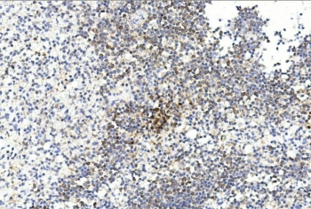 IHC staining of FFPE human spleen tissue with GREM1 antibody. HIER: steam section in pH6 citrate buffer for 20 min and allow to cool prior to staining.