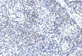 IHC staining of FFPE human spleen tissue with GREM1 antibody. HIER: steam section in pH6 citrate buffer for 20 min and allow to cool prior to staining.