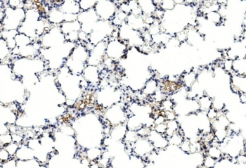 IHC staining of FFPE mouse lung tissue with GREM1 antibody. HIER: steam section in pH6 citrate buffer for 20 min and allow to cool prior to staining.