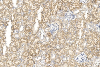 IHC staining of FFPE mouse kidney tissue with GREM1 antibody. HIER: steam section in pH6 citrate buffer for 20 min and allow to cool prior to staining.