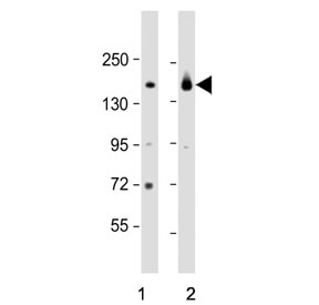 Western blot testing of 1) mouse heart and 2) rat heart tissue lysate with Myosin-binding protein C antibody. Predicted molecular weight ~141 kDa.