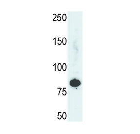 Western blot testing of human HepG2 cell lysate with PFKL antibody. Predicted molecular weight ~85 kDa.