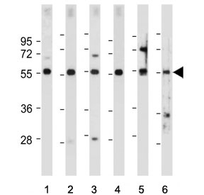 FOXD1 Antibody Human and Mouse WB. Western blot analysis of human HEK293, U-2 OS, U-87 MG, and Y79 cell lysates, as well as mouse kidney and mouse eyeball tissue lysates, using FOXD1 antibody demonstrates detection of a prominent immunoreactive band at approximately 46-55 kDa, consistent with expression of Forkhead Box Protein D1 (FOXD1). FOXD1 is a developmental transcription factor that regulates gene expression programs involved in tissue patterning, cellular differentiation, and organogenesis. The observed expression across both cultured cell lines and mouse tissues is consistent with the role of FOXD1 in developmental regulatory networks and maintenance of tissue-specific gene expression programs. Predicted molecular weight: ~46 kDa.