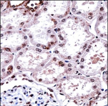 FOXD1 Antibody Human Kidney IHC. Immunohistochemistry staining of FFPE human kidney tissue using FOXD1 antibody demonstrates prominent nuclear staining within renal tubular epithelial cells, consistent with expression of Forkhead Box Protein D1 (FOXD1). FOXD1 is a developmental transcription factor that regulates gene expression programs involved in tissue patterning, cellular differentiation, and maintenance of specialized cellular identities. The observed nuclear localization is consistent with the role of FOXD1 as a DNA-binding transcriptional regulator and supports its involvement in developmental and tissue-specific regulatory pathways within the kidney. HIER: steam section in pH6 citrate buffer for 20 min and allow to cool prior to staining.
