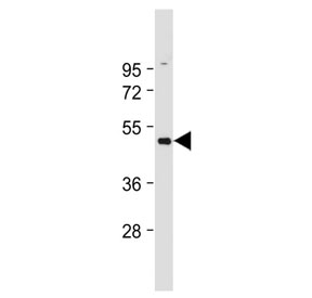 Western blot testing of HUVEC lysate with B2AR antibody. Predicted molecular weight ~46 kDa.