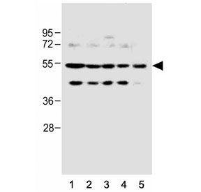 Western blot testing of human 1) Raji, 2) MOLT4, 3) NCI-H1299, 4) HEK293 and 5) U-87 MG cell lysate with PFKFB4 antibody. Predicted molecular weight ~54 kDa.