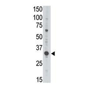 Western blot testing of human Jurkat cell lysate with MAGE3 antibody. Predicted molecular weight ~35 kDa.