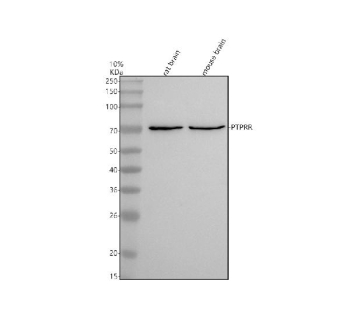 Western blot analysis of PTPRR using anti-PTPRR antibody. Electrophoresis was performed on a 10% SDS-PAGE gel at 80V (Stacking gel) / 120V (Resolving gel) for 2 hours. Lane 1: rat brain tissue lysates, Lane 2: mouse brain tissue lysates. After electrophoresis, proteins were transferred to a nitrocellulose membrane at 150 mA for 50-90 minutes. Blocked the membrane with 5% non-fat milk/TBS for 1.5 hour at RT. The membrane was incubated with rabbit anti-PTPRR antibody at 1:500 overnight at 4oC, then washed with TBS-10%Tween 3 times with 5 minutes each and probed with a goat anti-rabbit IgG-HRP secondary antibody at a dilution of 1:5000 for 1.5 hour at RT. The signal was developed using an ECL Plus Western Blotting Substrate. A specific band was detected for PTPRR at approximately 70 kDa. The expected band size for PTPRR is at 70 kDa.