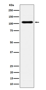 Western blot analysis of EXOC2 expression in BxPC-3 cell lysate. Predicted molecular weight ~104 kDa.
