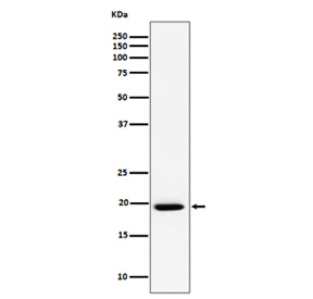 Western blot analysis of UFC1 expression in cell lysate using UFC1 antibody. Predicted molecular weight ~19 kDa.