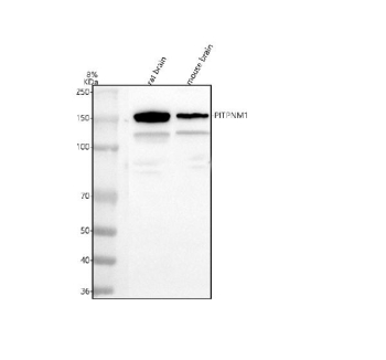 Western blot analysis of PITPNM1 using anti-PITPNM1 antibody. Lane 1: rat brain tissue lysates, Lane 2: mouse brain tissue lysates. After electrophoresis, proteins were transferred to a nitrocellulose membrane at 150 mA for 50-90 minutes. Blocked the membrane with 5% non-fat milk/TBS for 1.5 hour at RT. The membrane was incubated with rabbit anti-PITPNM1 antibody at 0.5 ug/ml overnight at 4oC, then washed with TBS-0.1%Tween 3 times with 5 minutes each and probed with a goat anti-rabbit IgG-HRP secondary antibody at a dilution of 1:5000 for 1.5 hour at RT. The signal was developed using enhanced chemiluminescent. Expected size for PITPNM1 ~135 kDa. Observed strong band at ~150 kDa and a lighter band at ~120 kDa in mouse/rat brain lysate. The higher band likely corresponds to full-length or modified PITPNM1, while the lighter band may reflect a splice variant or truncated form. Alternative isoforms of PITPNM1 and membrane-associated processing of this multi-domain protein have been reported in the literature