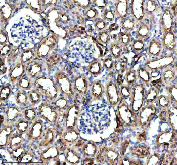 IHC analysis of GHRHR using anti-GHRHR antibody. GHRHR was detected in a paraffin-embedded section of rat kidney tissue. Heat mediated antigen retrieval was performed in EDTA buffer (pH 8.0, epitope retrieval solution). The tissue section was blocked with 10% goat serum. The tissue section was then incubated with 2 ug/ml rabbit anti-GHRHR antibody overnight at 4oC. Peroxidase Conjugated Goat Anti-rabbit IgG was used as secondary antibody and incubated for 30 minutes at 37oC. The tissue section was developed using an HRP secondary and DAB substrate.