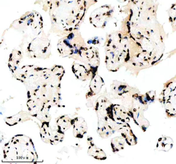 IHC analysis of Histone H3 (acetyl K14) using anti-Histone H3 (acetyl K14) antibody. Histone H3 (acetyl K14) was detected in a paraffin-embedded section of human placenta tissue. Heat mediated antigen retrieval was performed in EDTA buffer (pH 8.0, epitope retrieval solution). The tissue section was blocked with 10% goat serum. The tissue section was then incubated with a dilution of 1:50 rabbit anti-Histone H3 (acetyl K14) antibody overnight at 4oC. Peroxidase Conjugated Goat Anti-rabbit IgG was used as secondary antibody and incubated for 30 minutes at 37oC. The tissue section was developed using an HRP secondary and DAB substrate.